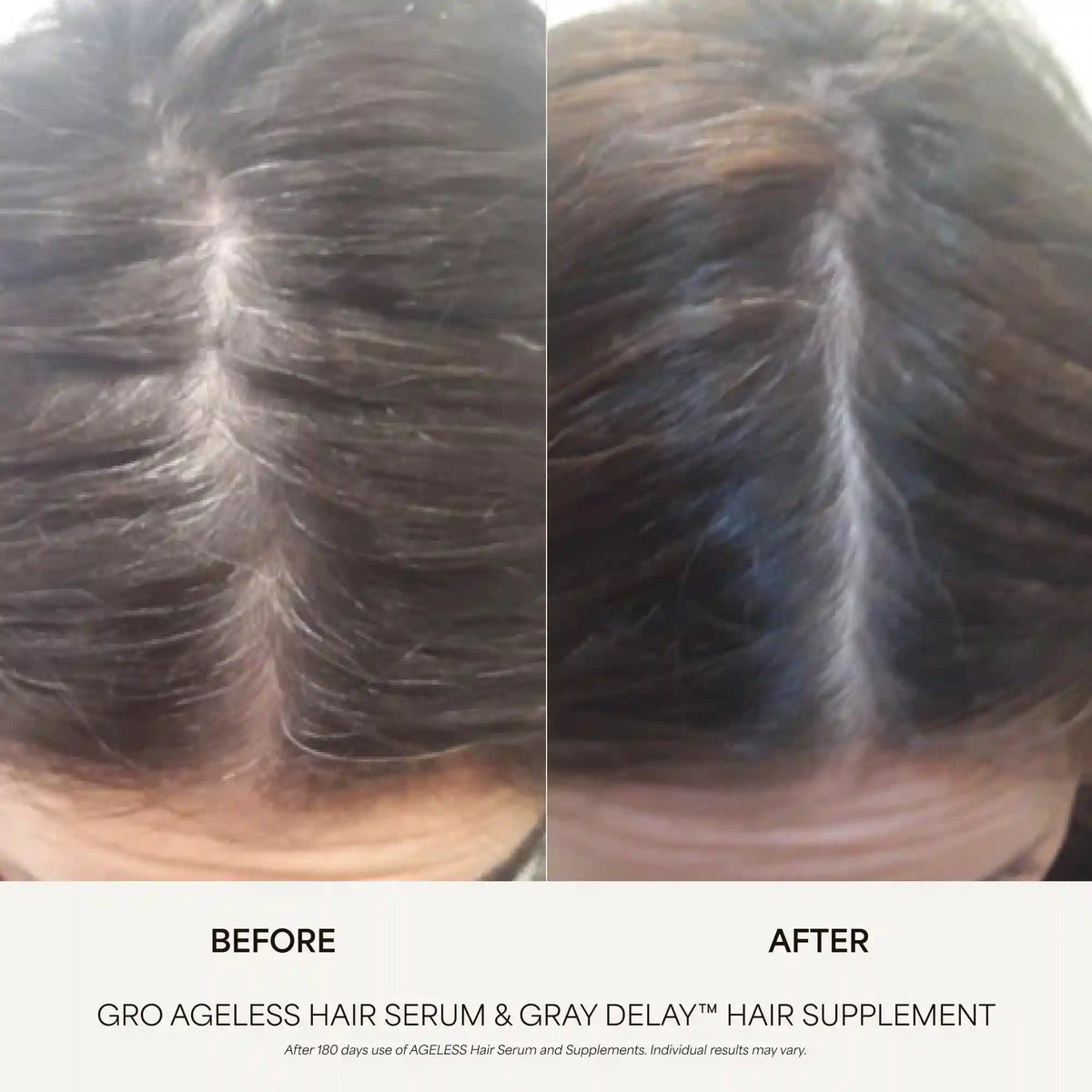 AGELESS Gray Control Duo