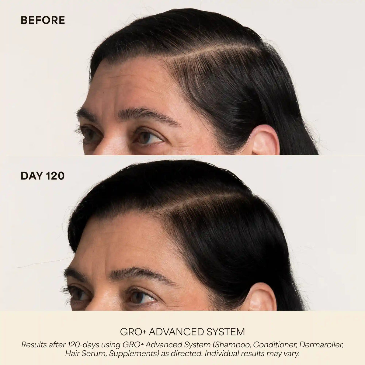 GRO+ Advanced Gel-Serum Pen