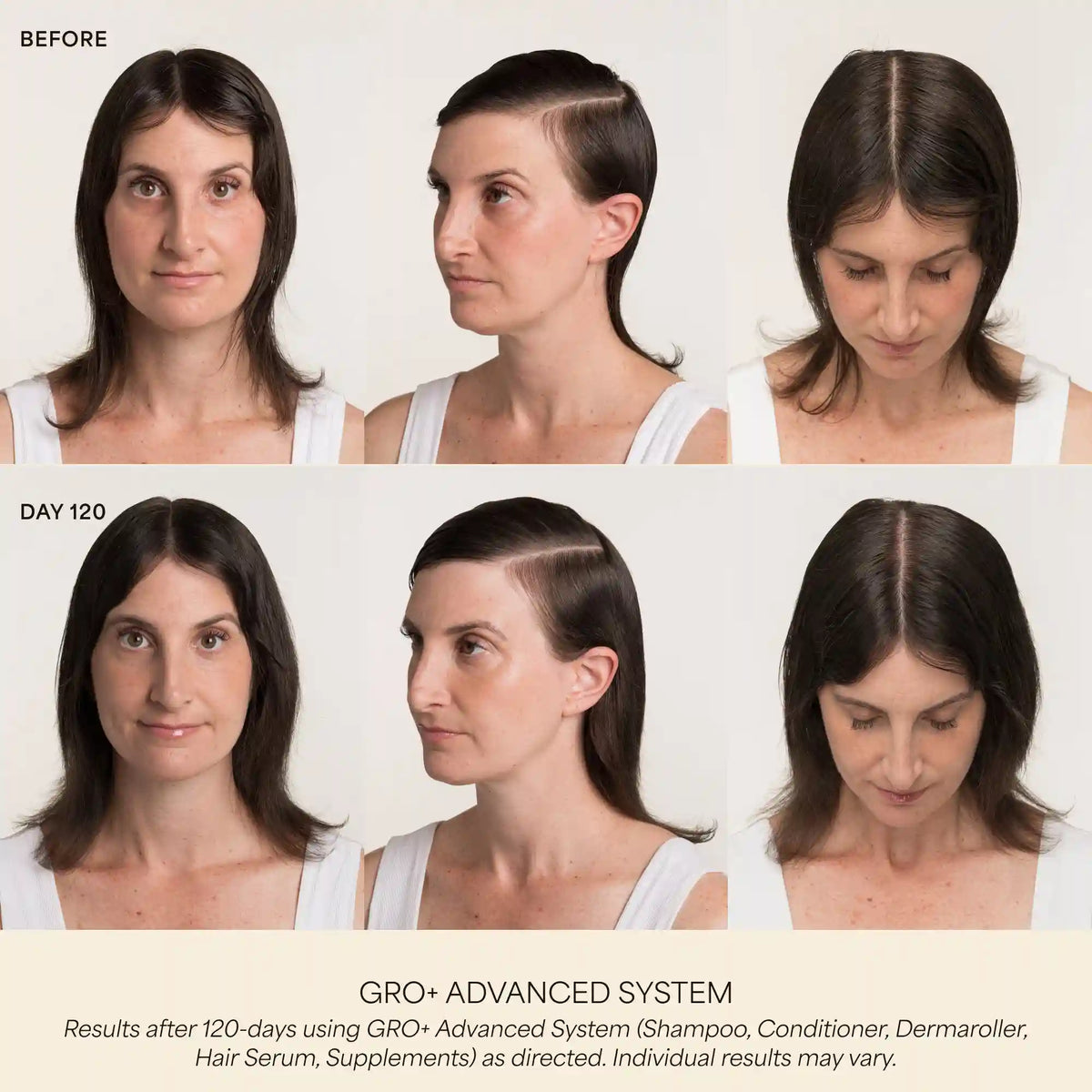 GRO+ Advanced Dermaroller