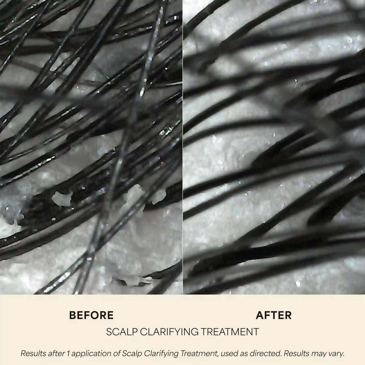 Scalp Clarifying Treatment